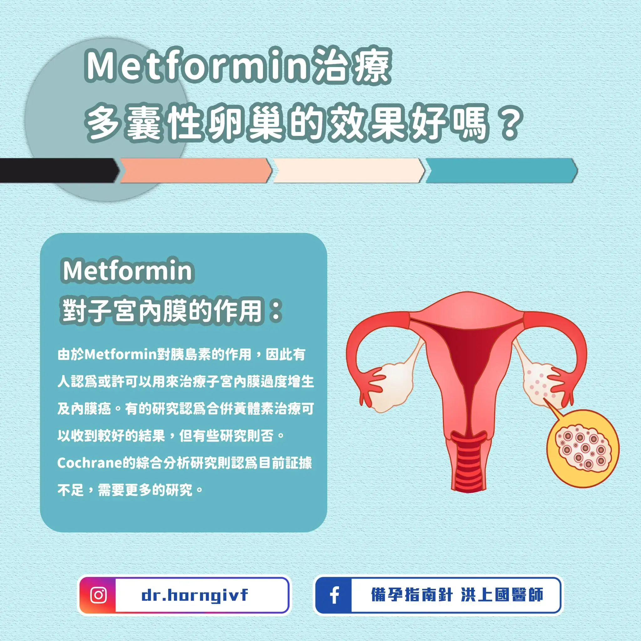 Metformin口服藥物，治療多囊性卵巢的效果好嗎？