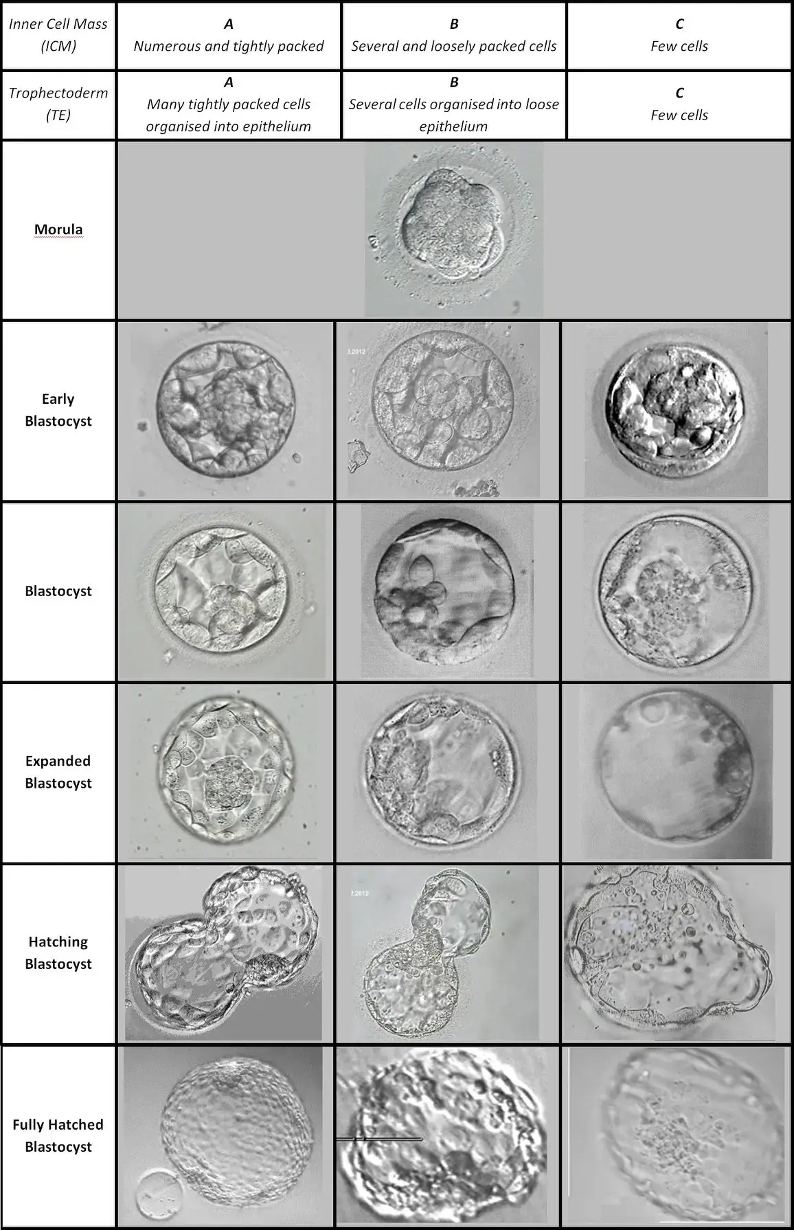 囊胚期胚胎分級圖：3種胚胎分級解析