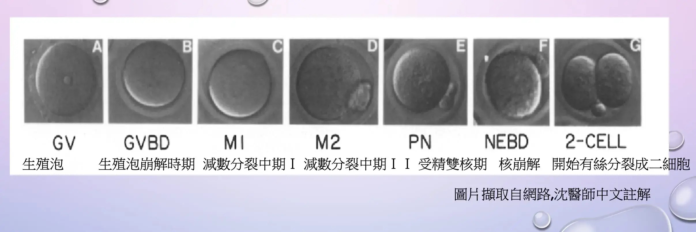 體外成熟培養(IVM)技術是什麼？可以被應用在什麼情況？
