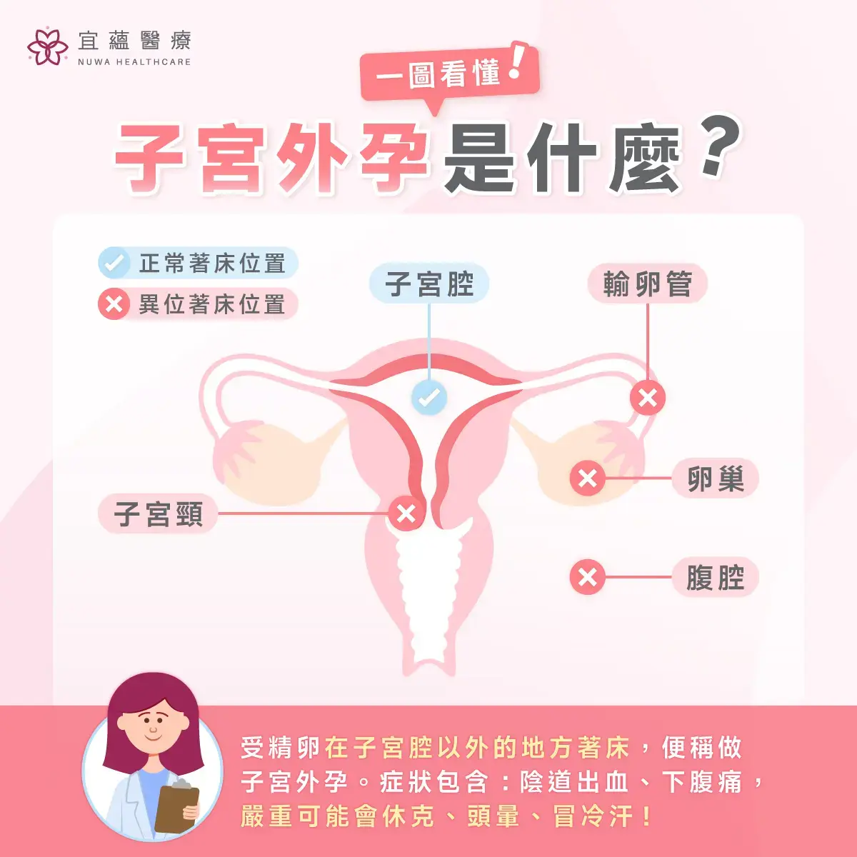 子宫外孕是什么？子宫外孕位置、常见症状、需特别留意的征兆