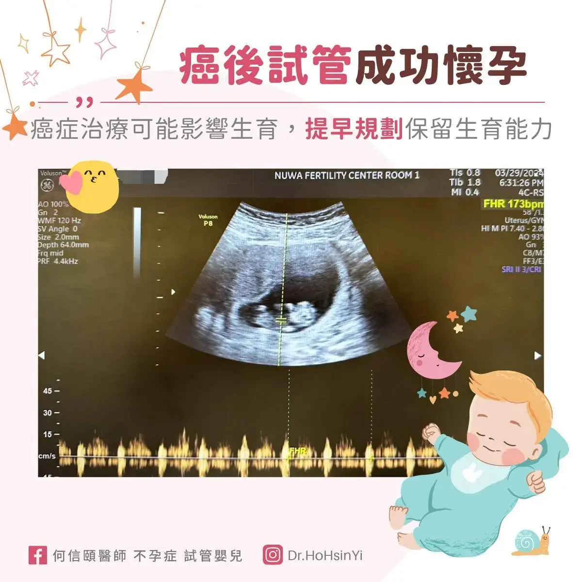 癌症治療可能影響生育力，提早規劃凍精或凍卵保存生育能力，分享癌後試管嬰兒成功懷孕案例