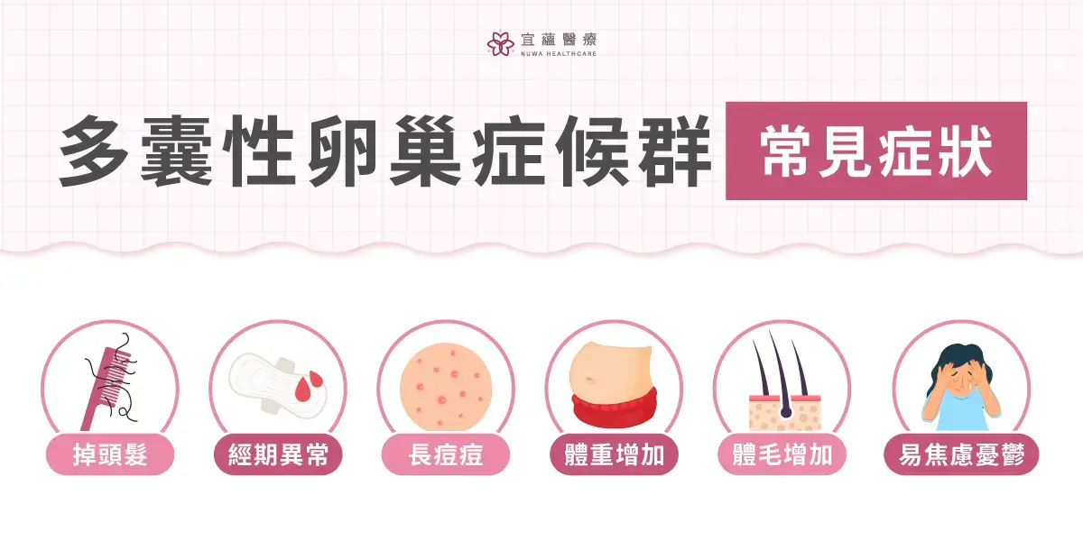 多囊性卵巢症候群常見症狀