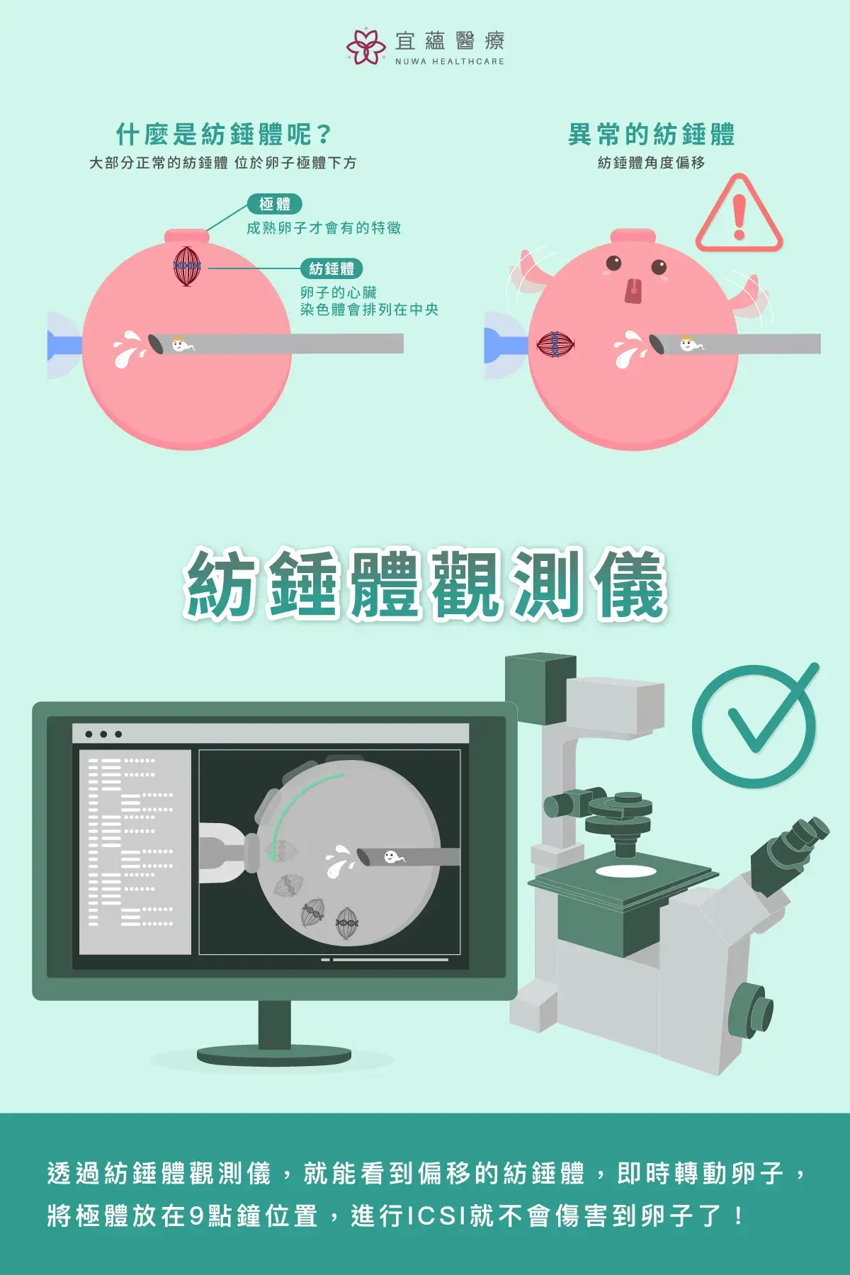 認識紡錘體及紡錘體觀測儀如何使用