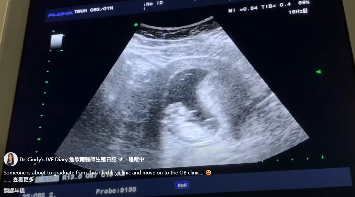 IVF Success After Male Factor Infertility